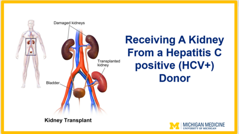 Thumbnail for entry Receiving A Kidney From a Hepatitis C positive (HCV+) Donor