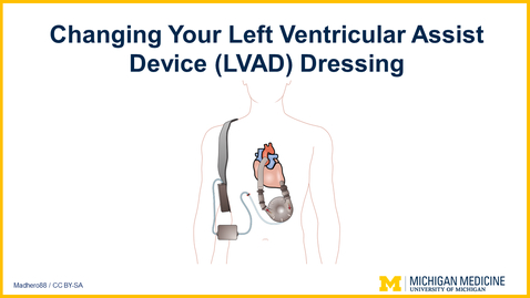 Thumbnail for entry Changing Your Left Ventricular Assist Device (LVAD) Dressing