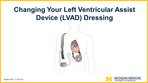 Thumbnail for Changing Your Left Ventricular Assist Device (LVAD) Dressing