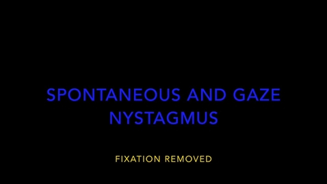 Thumbnail for ICVR 2022 Spontaneous and Gaze Nystagmus without Fixation.mp4