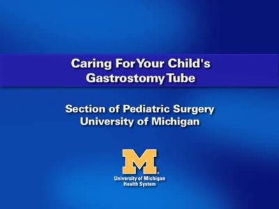 8. Gastrostomy Tube - Venting the G-tube and button