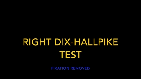 Thumbnail for entry Right Dix-Hallpike Direction changing Nystagmus within one position