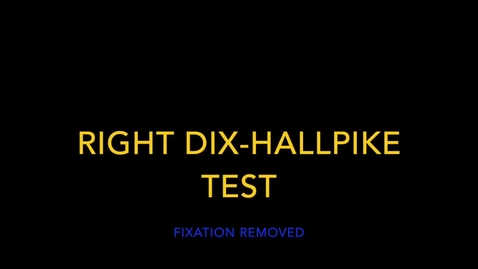 Thumbnail for Right Dix-Hallpike Direction changing Nystagmus within one position