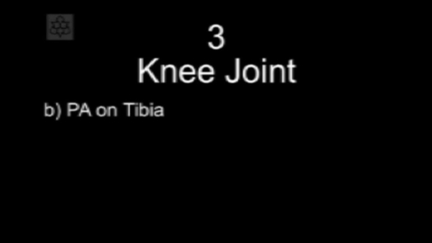 Thumbnail for entry Manual Therapy Knee Joint PA on Tibia