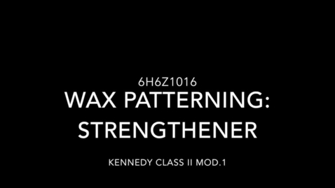 Thumbnail for Kennedy Class II Mod. 1 - Wax patterning: Strengthener