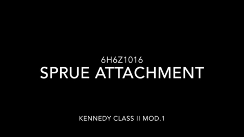 Thumbnail for Kennedy Class II Mod. 1 - Sprue attachment