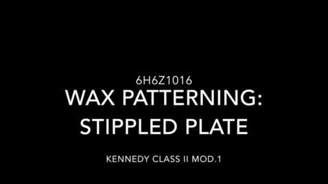 Thumbnail for Kennedy Class II Mod.1: Wax patterning - Stippled plate