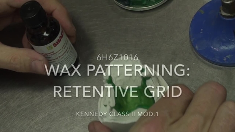 Thumbnail for Kennedy Class II Mod. 1 - Wax patterning: Retentive grid