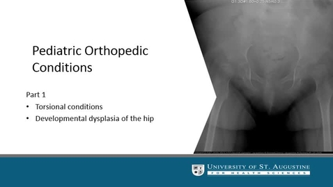 Thumbnail for PHT_5610C_Unit 4_Pediatric Orthopedic Conditions 1_USA_Templat.mp4
