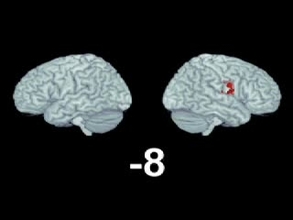 More Testing Less Play Study Finds >> Music Moves Brain To Pay Attention Stanford Study Finds News More Testing Less Play Study Finds >> Music Moves Brain To Pay Attention Stanford Study Finds News