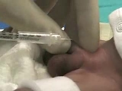 Plastibell Technique Newborn Nursery Stanford Medicine