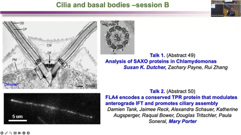 Thumbnail for entry Cilia and basal bodies B - Chair- Hongmin Qin