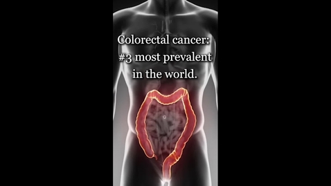 Thumbnail for entry Colorectal Cancer: A Global Health Problem