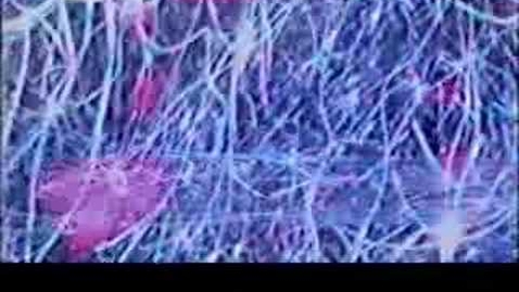 Thumbnail for PSY 3203 997 - Part 4 - Phantoms In The Brain (Episode 2)