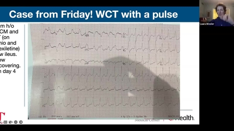 Thumbnail for entry ECG: Wide Complex Tachycardia 