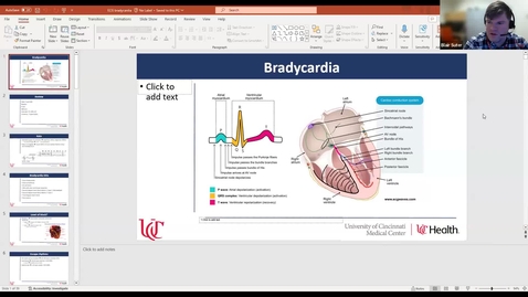 Thumbnail for EKG: Bradycardia 