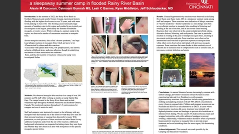 Thumbnail for Corcoran, A  “Skeeter Syndrome” and other mosquito hypersensitivity reactions at a sleepaway summer camp in flooded Rainy River Basin