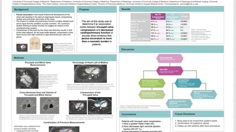 Thumbnail for entry Carroll, M, Tricuspid Valve Compression and Cardiopulmonary Function in Patients with Pectus Excavatum