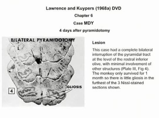 Thumbnail for the embedded element "4 days after pyramidotomy | K06_Chapter_06"