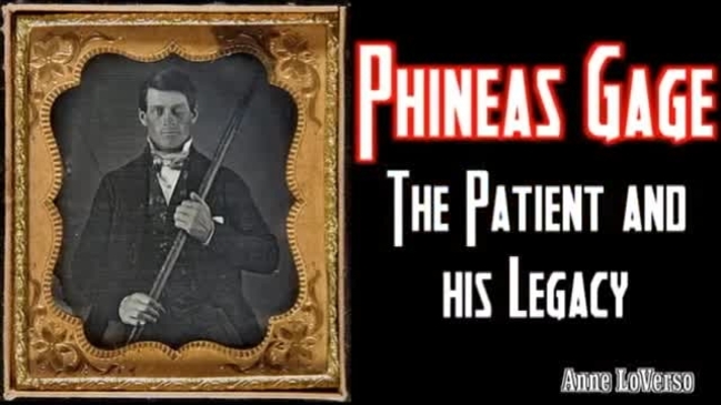 Thumbnail for the embedded element "Phineas Gage | The Patient and His Legacy"