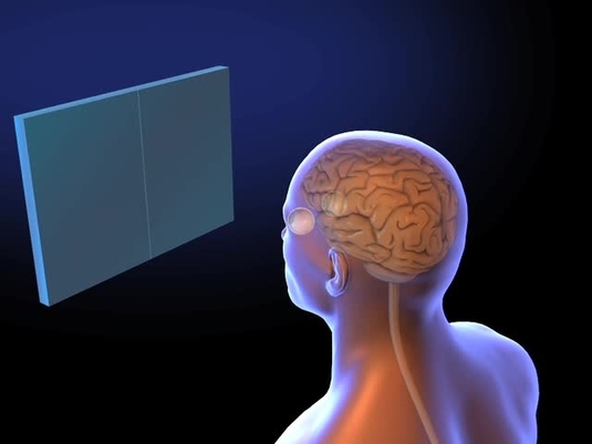 Thumbnail for the embedded element "Visual orientation selectivity | Bear et al. Neuroscience, 2016"