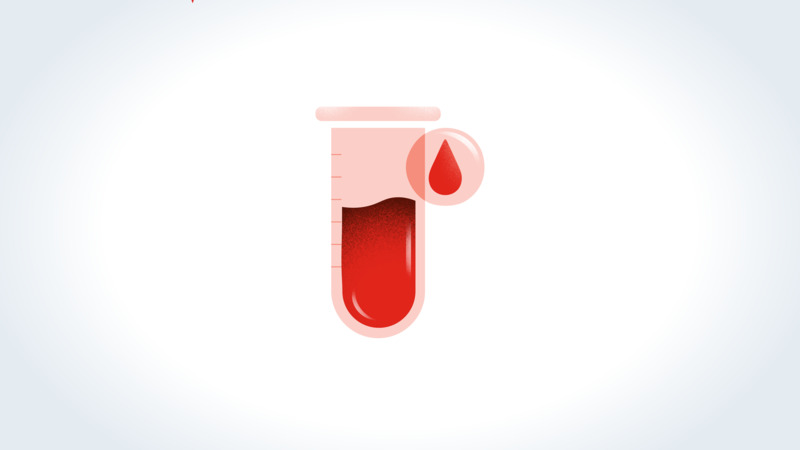 Lipoprotein(a): Why is it Important to Test Lp(a) Levels?