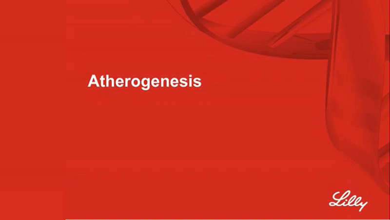 Atherogenesisundefined
