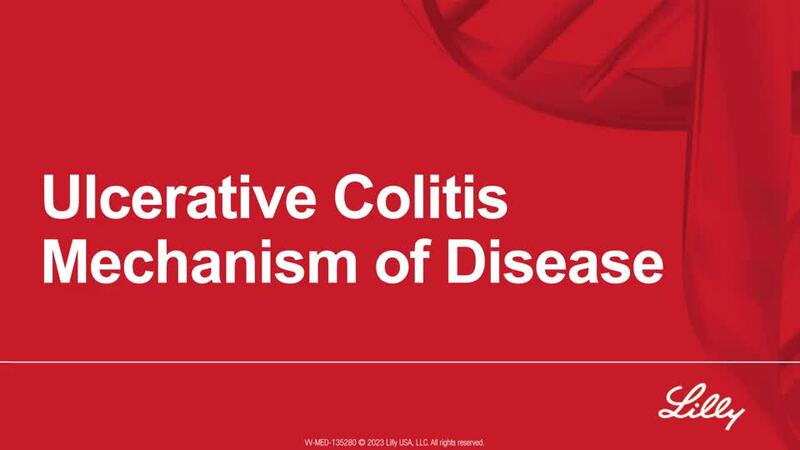 Ulcerative Colitis Mechanism of Disease
