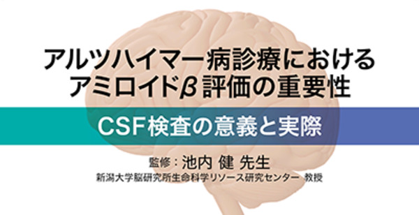 アルツハイマー病診療におけるアミロイドβ評価の重要性−CSF検査の意義