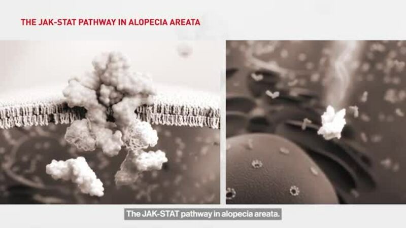 Chapter 3: The JAK-STAT Pathway in Alopecia Areata