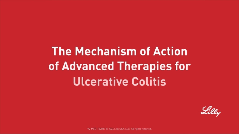 The Mechanism of Action of Advanced Therapies for Ulcerative Colitis
