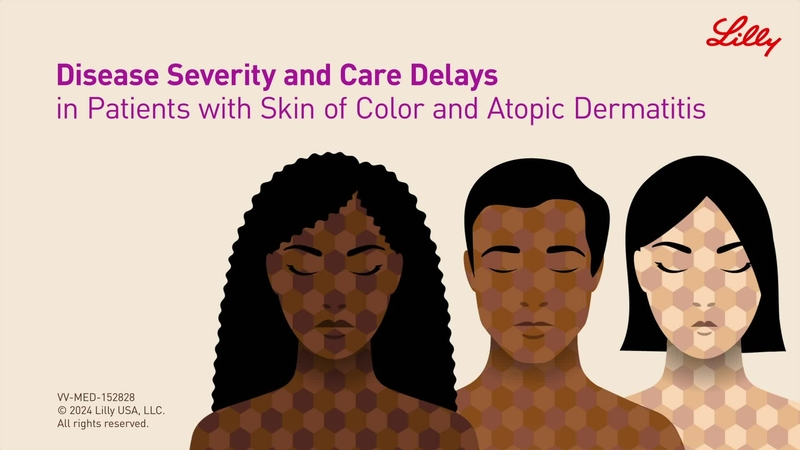 Disease Severity and Care Delays in Patients with Skin of Color and Atopic Dermatitis