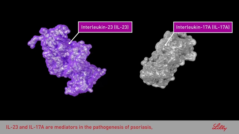 The Roles of IL-23 and IL-17 in the Pathophysiology of Plaque Psoriasis (MoD) Video
