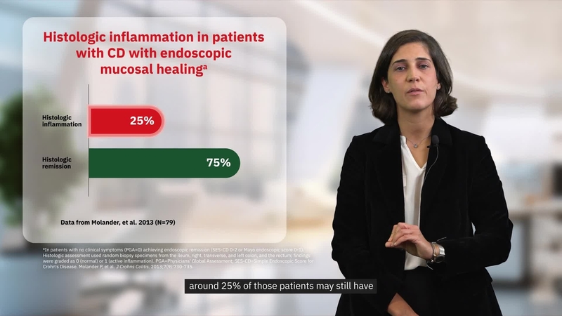 The Potential of Histology in Crohn’s Disease. Presented by Prof. Joana Torres