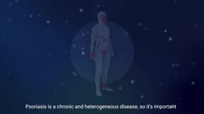 Understanding Patient Goals in Moderate to Severe Plaque Psoriasis
