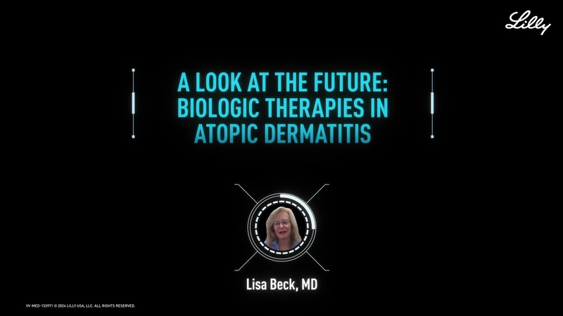 A Look at The Future: Biologic Therapies in Atopic Dermatitis