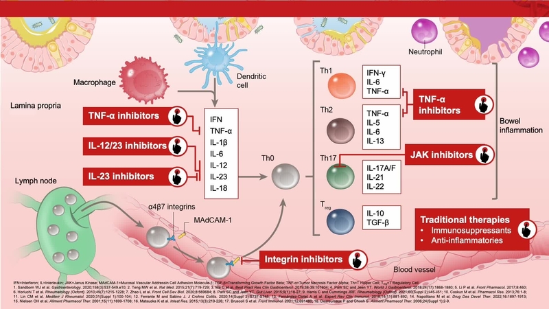 Crohn’s Disease Treatment Landscape: Approved Therapeutic Classes for Crohn’s Disease