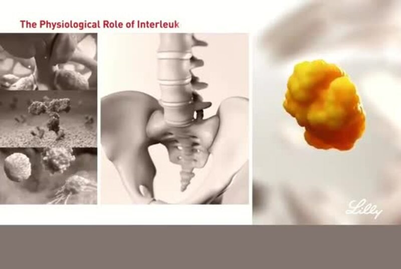 The Physiological Role of Interleukin-17A (IL-17A)