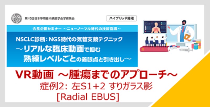 【VR動画：症例2】腫瘍までのアプローチ（Radial EBUS LT S1＋2）第45回日本呼吸器内視鏡学会学術集会会長企画セミナー