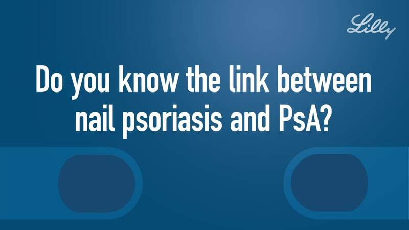 Do you know the link between nail psoriasis and PsA?