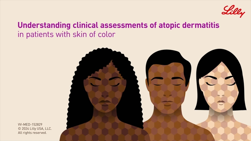 Understanding Clinical Assessments of Atopic Dermatitis in Patients with Skin of Color