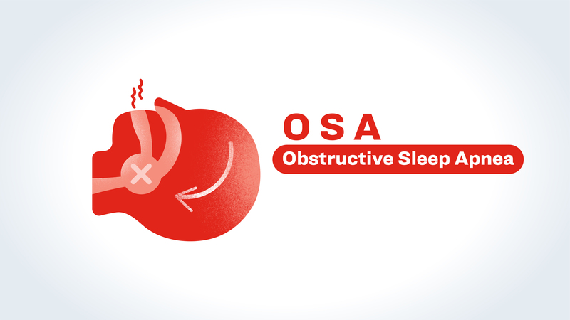 OSA Pathophysiology
