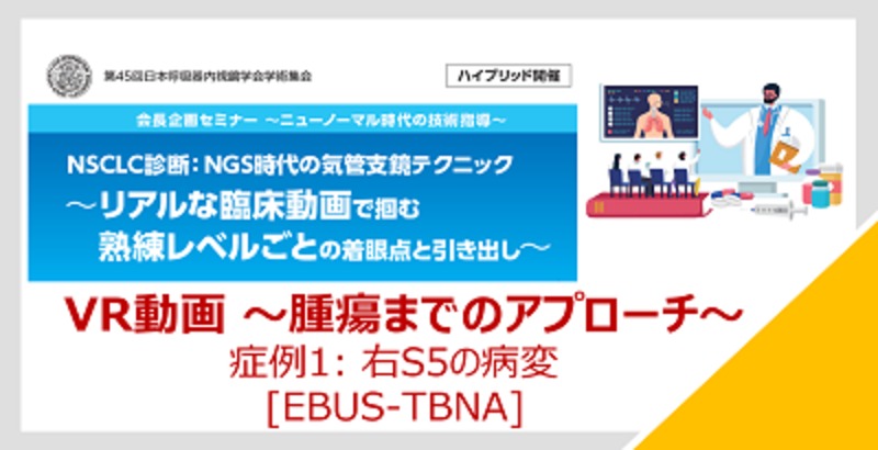 【VR動画：症例1】腫瘍までのアプローチ（EBUS-TBNA RT S5）第45回日本呼吸器内視鏡学会学術集会会長企画セミナー