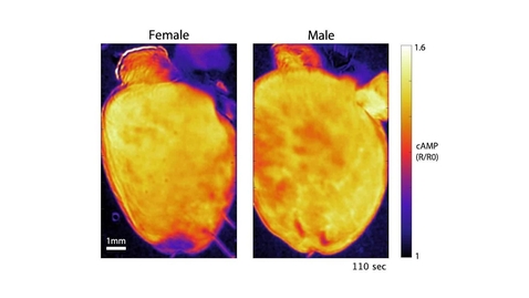 Thumbnail for entry Female and Male Mouse Hearts Responding to the Stress Hormone Noradrenaline