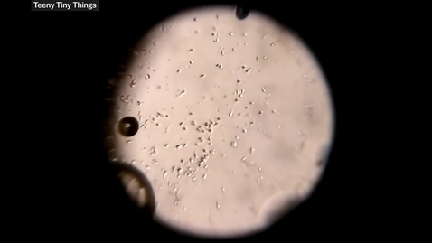 Thumbnail for The remarkable discovery of microbial life
