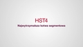 PLM_Hilti_HST4_MainFeature__1080p_PL (3406273)
