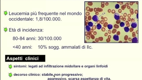Thumbnail for Una malattia linfoproliferativa con evoluzione anomala
