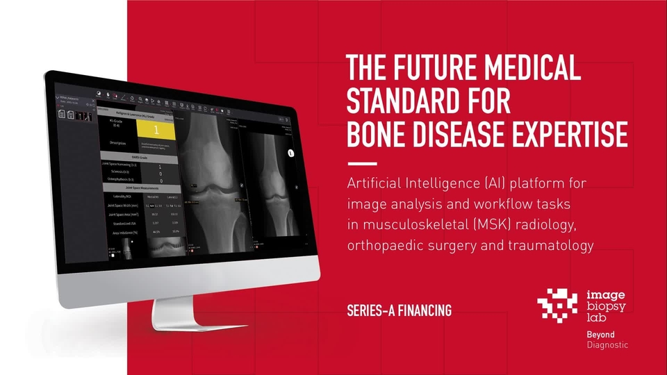 unforgivable Be surprised Opaque AI-Based Prediction in Bone Diseases | NVIDIA On-Demand