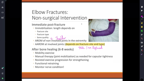 Thumbnail for MMIII 735 2022 Elbow Lecture - Reinking