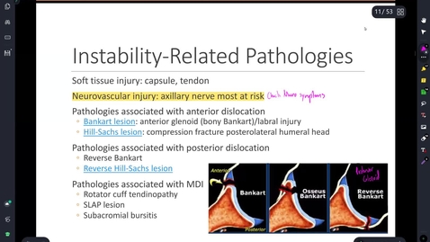 Thumbnail for MMIII 735 Shoulder Lecture/Session III 2022
